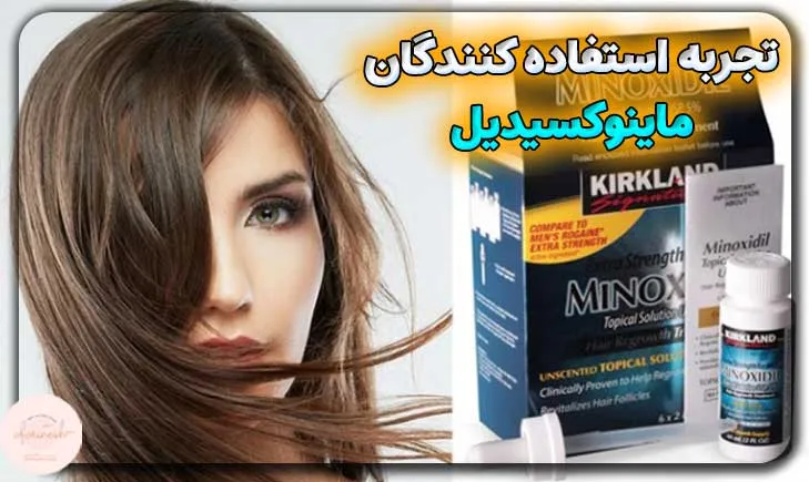 تجربه استفاده کنندگان از ماینوکسیدیل