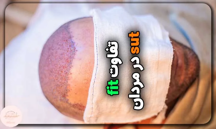 تفاوت روش sut و fit از نظر مزایا