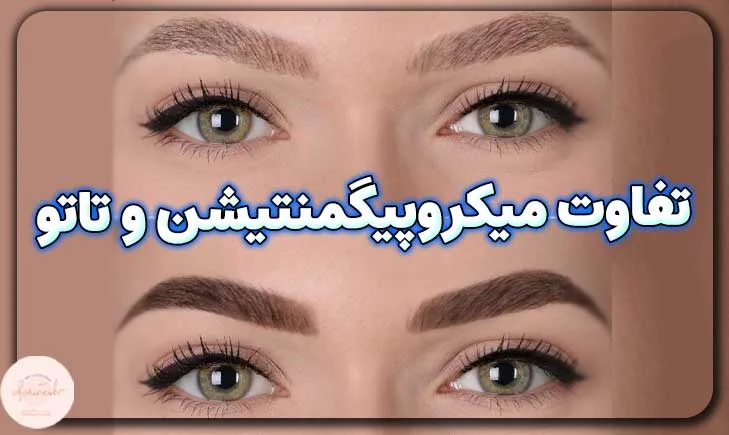 تفاوت میکروپیگمنتیشن و تاتو