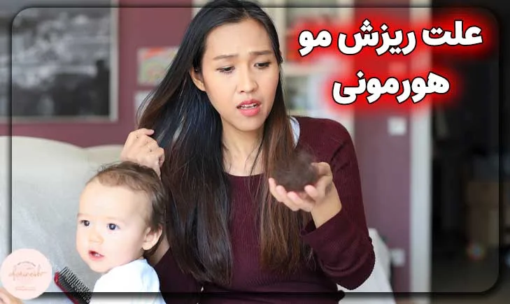 علت ریزش مو هورمونی چیست