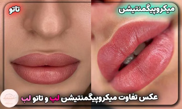 عکس تفاوت میکروپیگمنتیشن لب و تاتو لب