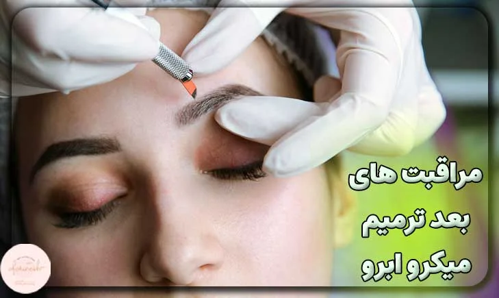 مراقبت های بعد از ترمیم میکرو ابرو