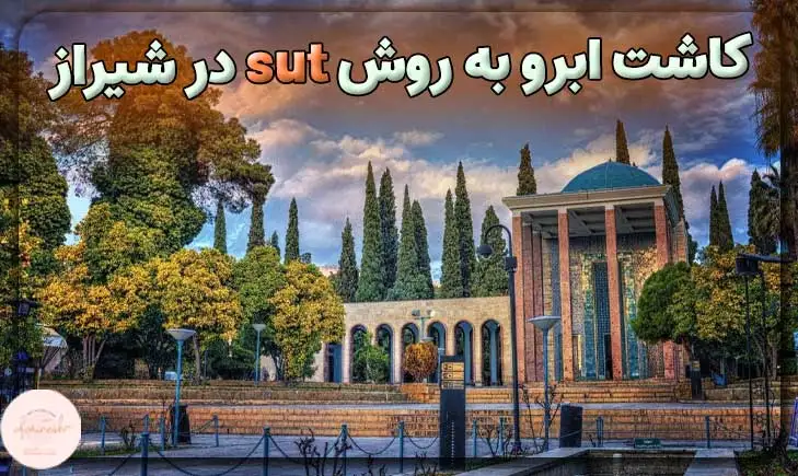 کاشت ابرو به روش sut در شیراز