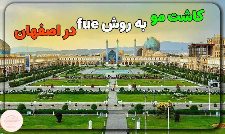 کاشت مو به روش fue در اصفهان
