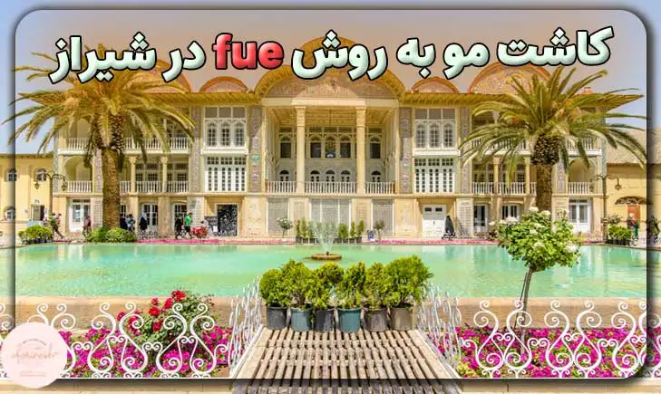 کاشت مو به روش fue در شیراز