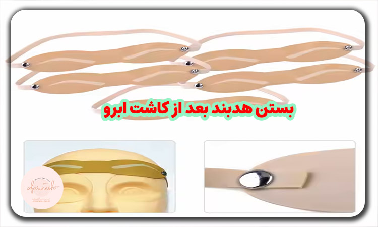 بستن هدبند بعد از کاشت ابرو