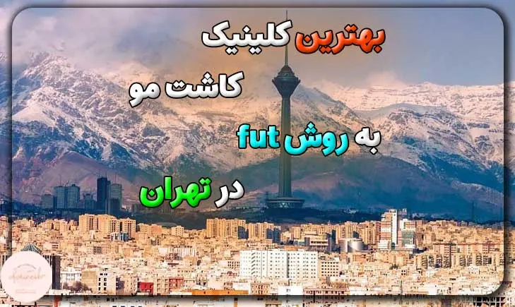 بهترین کلینیک کاشت مو به روش fut در تهران
