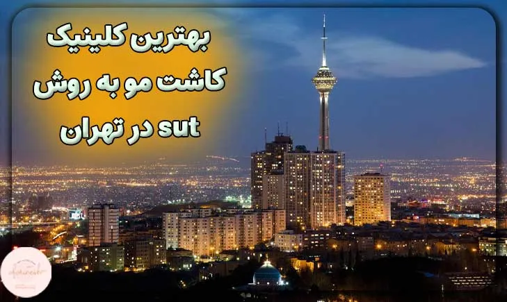 بهترین کلینیک کاشت مو به روش sut در تهران