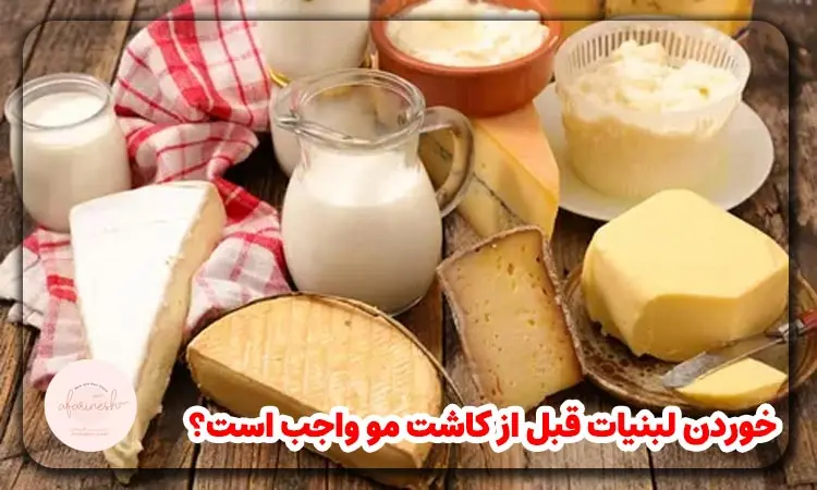 خوردن لبنیات قبل از کاشت مو
