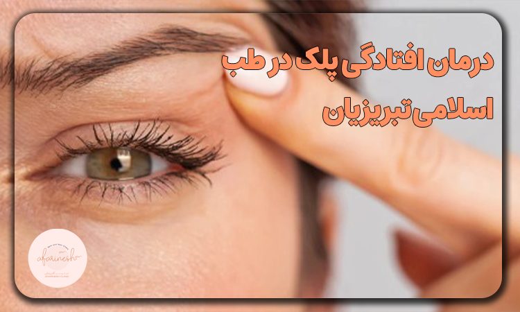 درمان افتادگی پلک در طب اسلامی تبریزیان