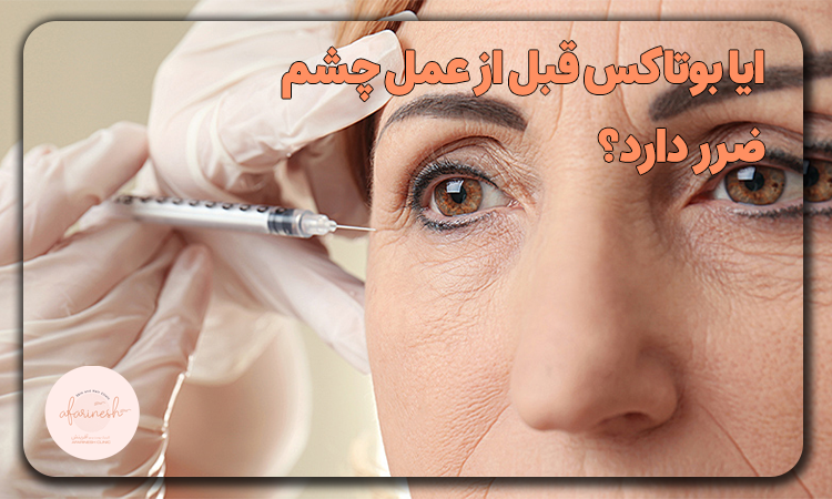 ایا بوتاکس قبل از عمل چشم ضرر دارد؟