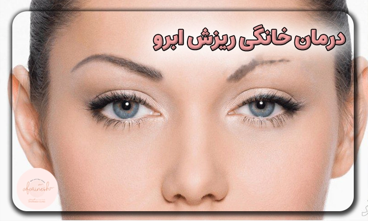 درمان خانگی ریزش ابرو