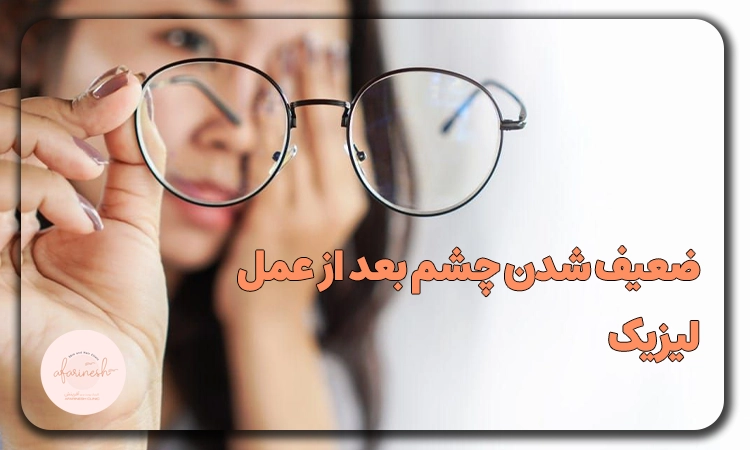 ‏ضعیف شدن چشم بعد از عمل لیزیک