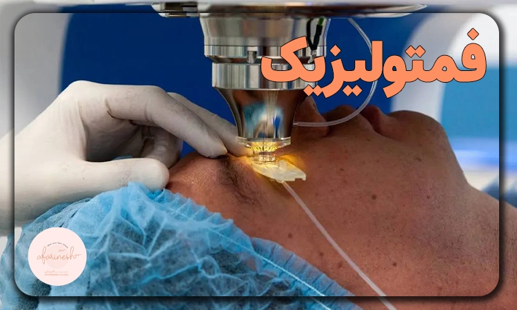 فمتولیزیک