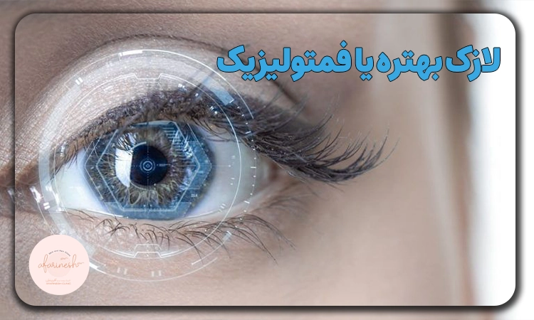 لازک بهتره یا فمتولیزیک