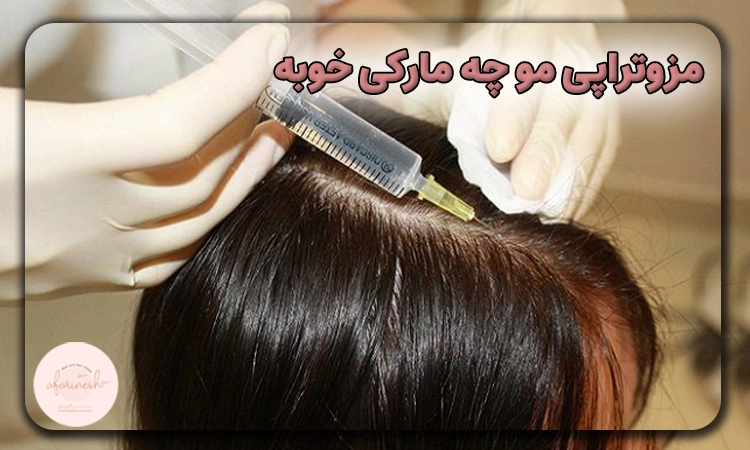 مزوتراپی مو چه مارکی خوبه