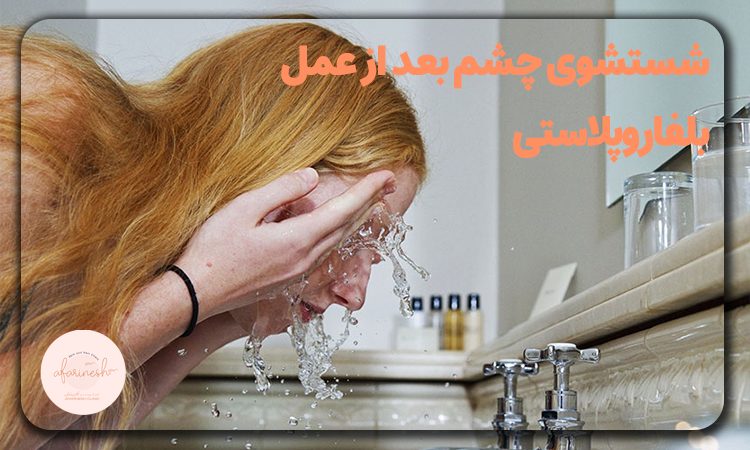 شستشوی چشم بعد از عمل بلفاروپلاستی