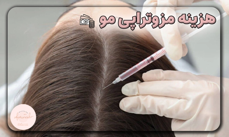 هزینه مزوتراپی مو