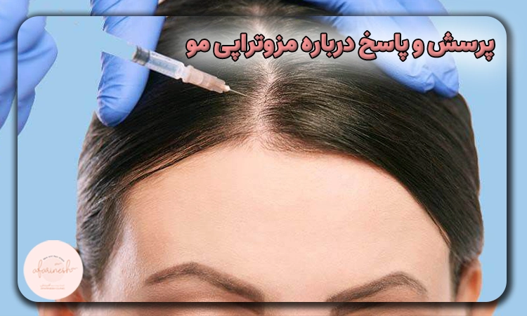 پرسش و پاسخ درباره مزوتراپی مو
