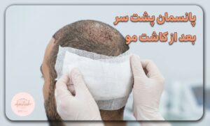 پانسمان پشت سر بعد از کاشت مو