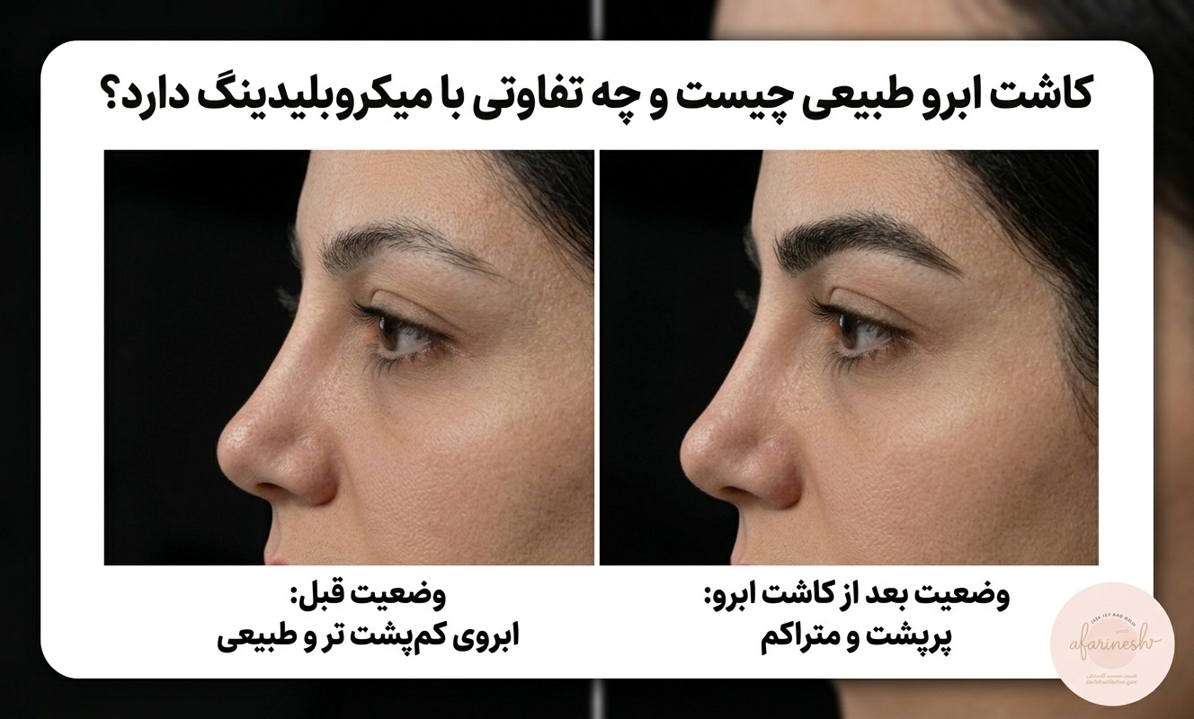 کاشت ابرو طبیعی چیست و چه تفاوتی با میکروبلیدینگ دارد؟