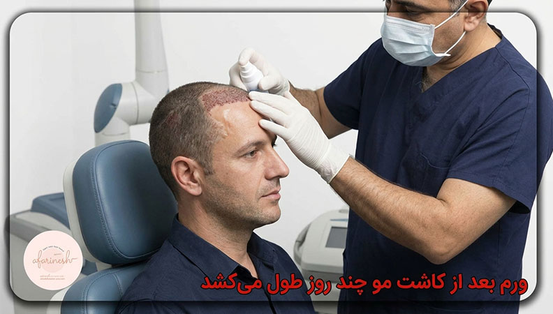 ورم بعد از کاشت مو چند روز طول میکشد